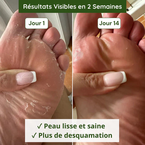 Savon purifiant, soins pieds sans odeurs