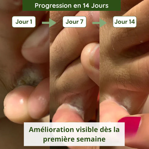 Savon purifiant, soins pieds sans odeurs